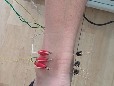 What is Electro-Medical Acupuncture (EMA)?